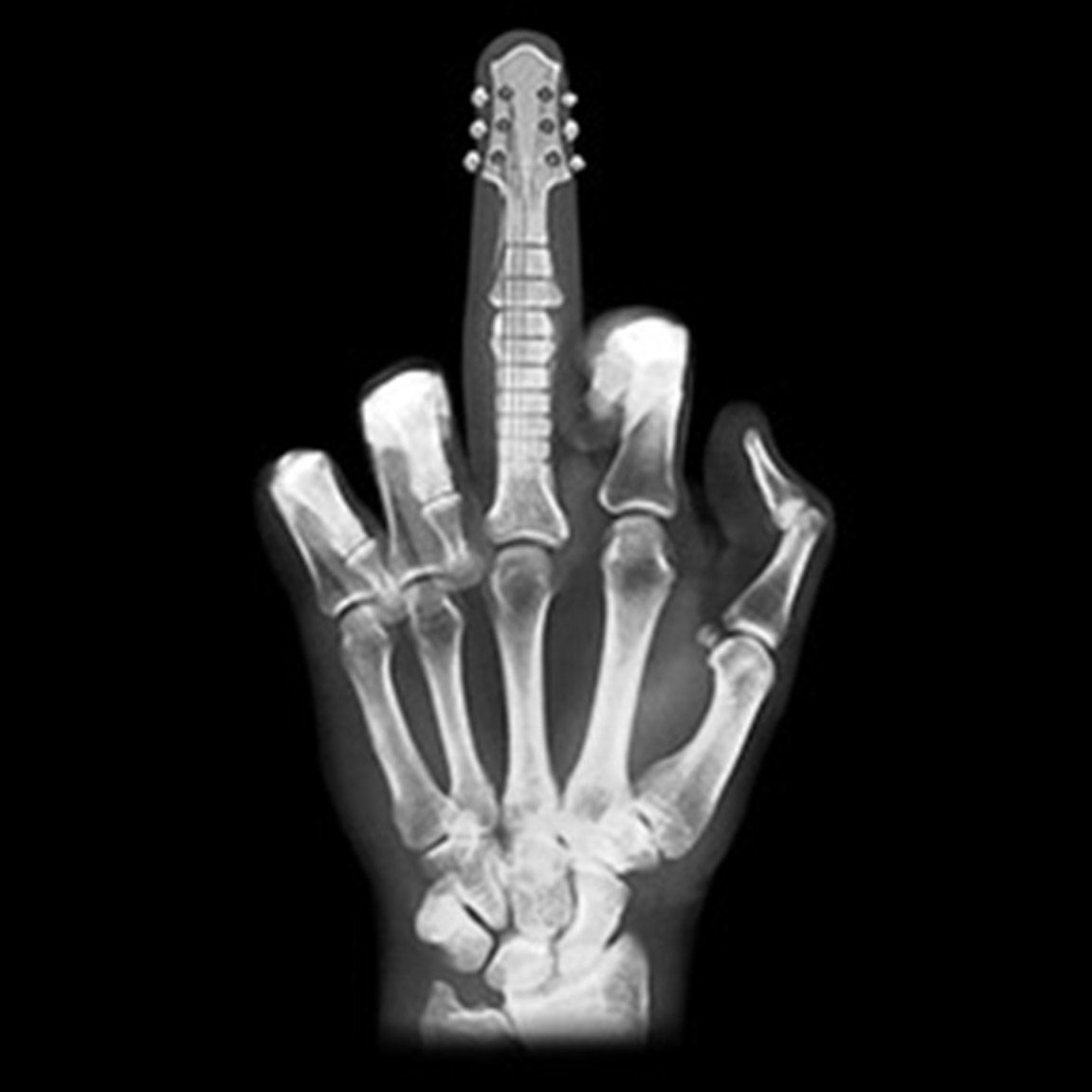 Diseño Camiseta Radiografía Mano Dedo Guitarra